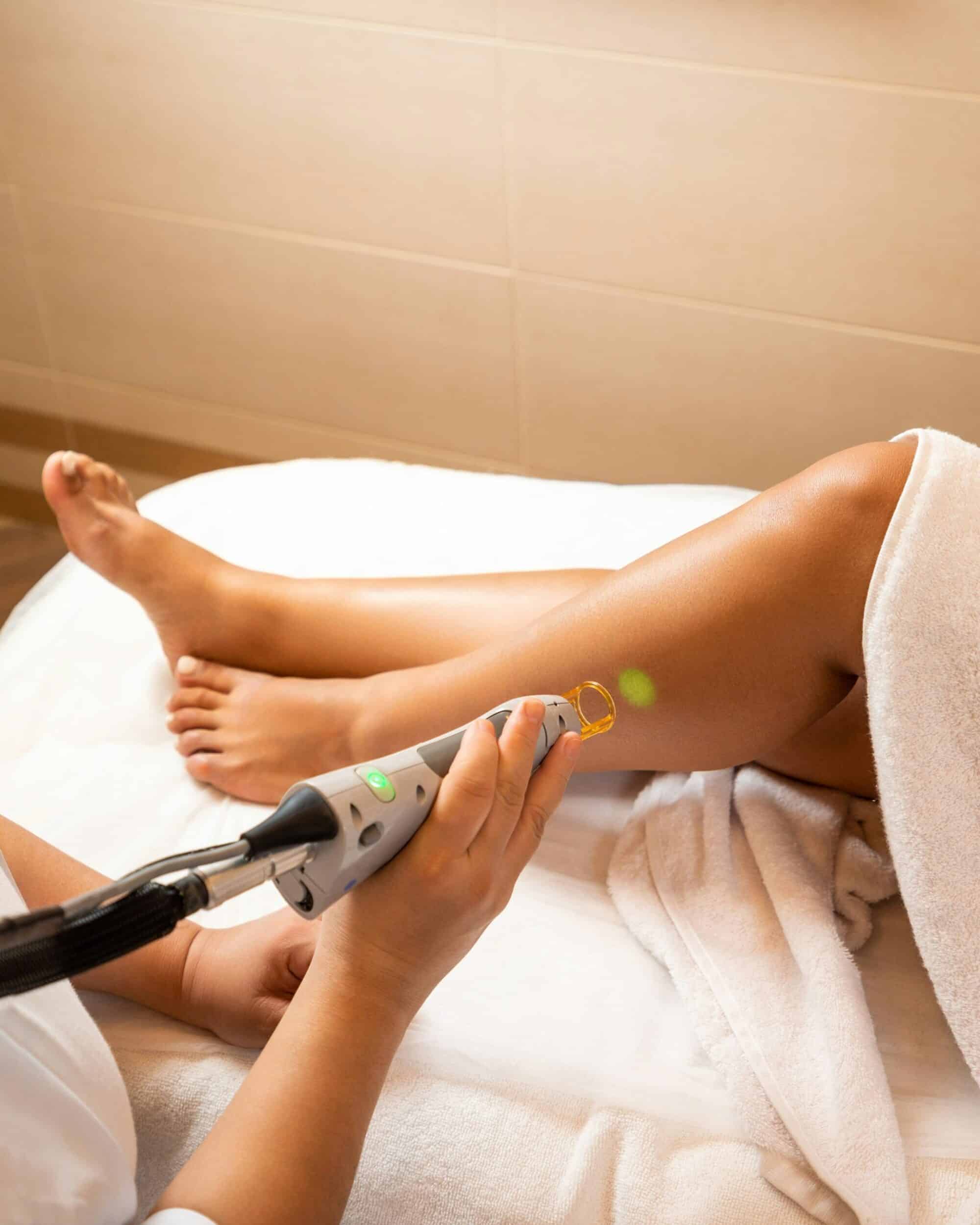 laser treatment wishlane aesthetics and wellness appleton wi