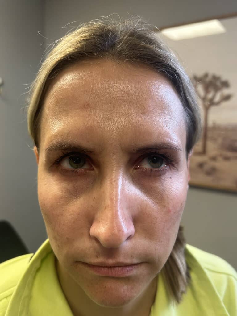 After Image: Tox - front