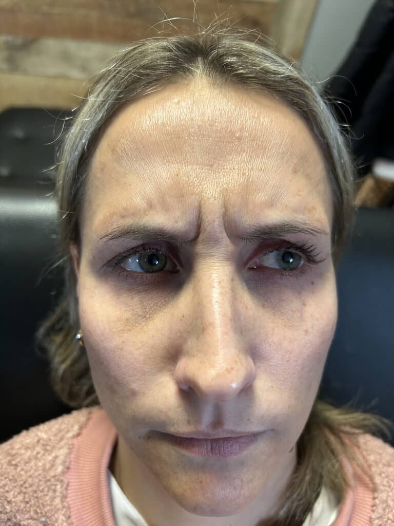 Before Image: Tox - front