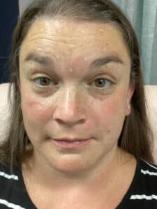 Before Image: Tox