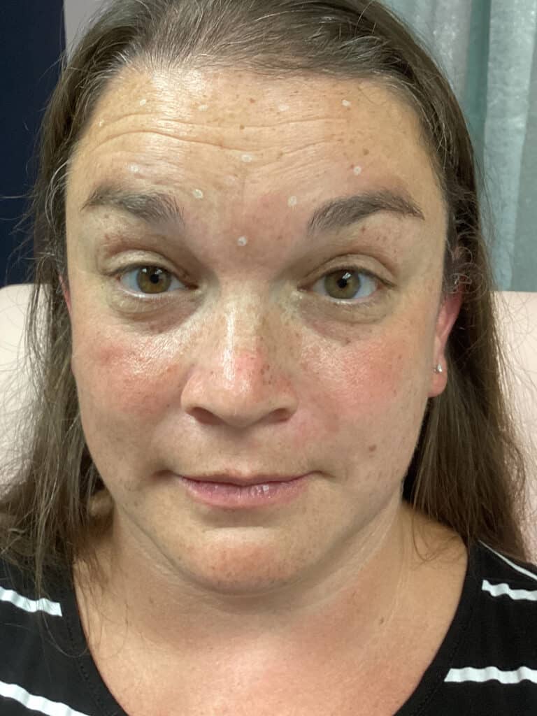 Before Image: Tox - front