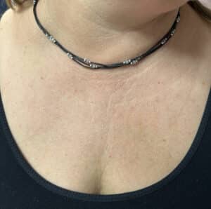 After Image: IPL Neck