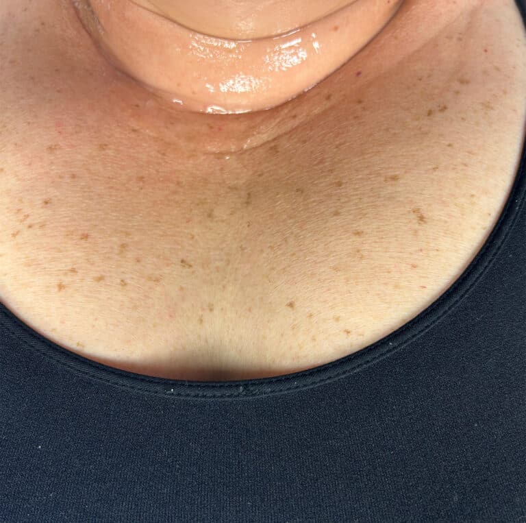 Before Image: IPL Neck - front